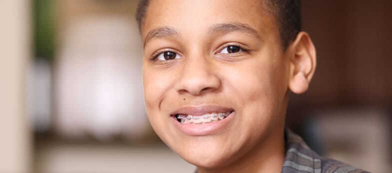 Conventional Braces Wimbledon - A young patient is smiling, showcasing their conventional braces, a common orthodontic treatment provided by Ridgway Dental, a dental clinic in Wimbledon. The braces are clearly visible on the patient's teeth, illustrating the clinic's expertise in orthodontics aimed at correcting misaligned teeth and enhancing the patient's smile. The patient appears confident and at ease, highlighting the supportive and professional environment at Ridgway Dental. This image emphasizes the clinic's commitment to offering effective and comfortable orthodontic solutions to their patients in Wimbledon.